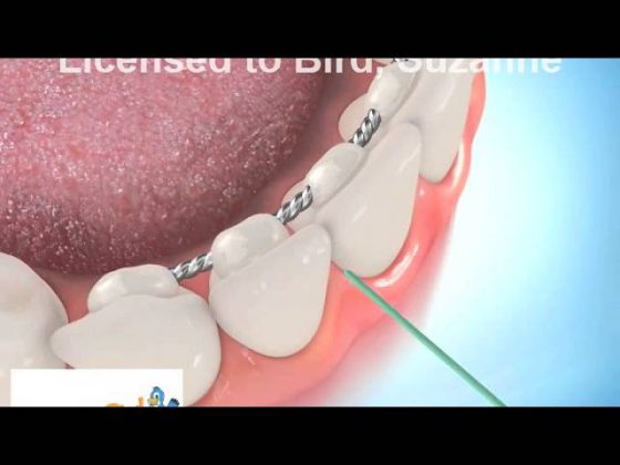 How to Use a Floss Threader thumbnail
